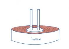 Frostline terasse-forh�jningss�t